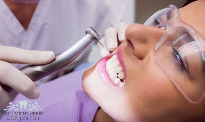 Cracked-Tooth-Repair-Littleton-CO
