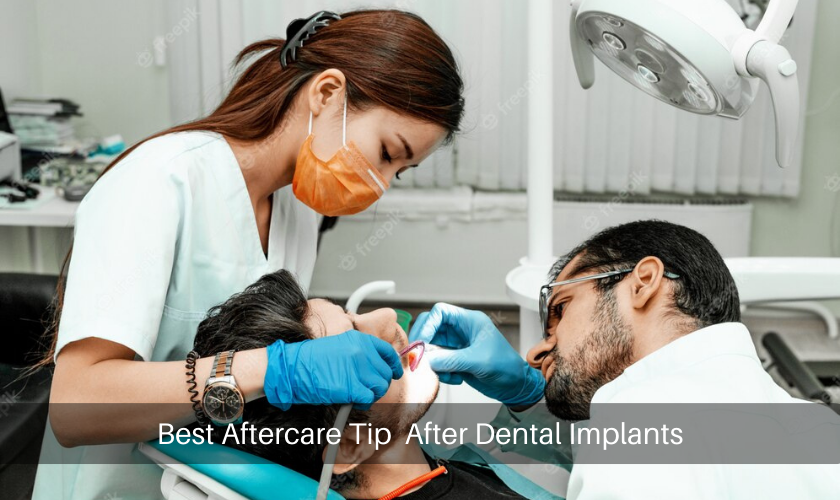 Best Aftercare Tip After Dental Implants
