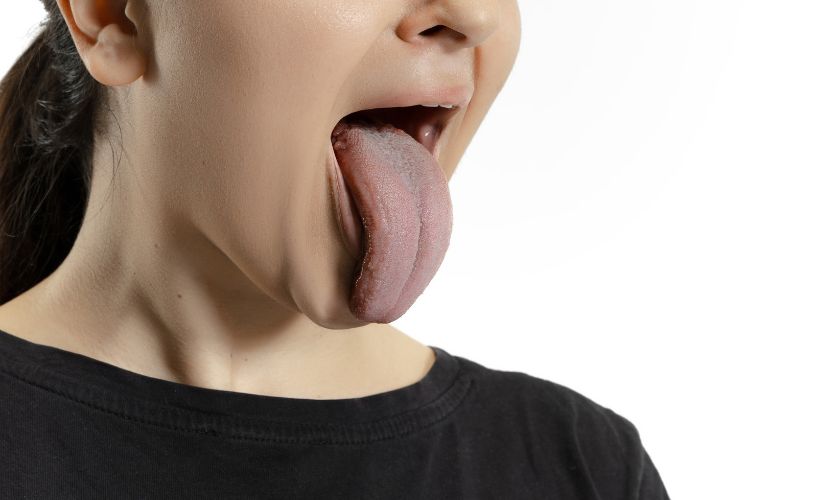 The Importance of Oral Hygiene in Preventing Halitosis
