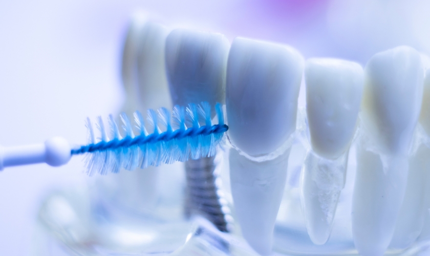 Dental Cleanings in Littleton, CO