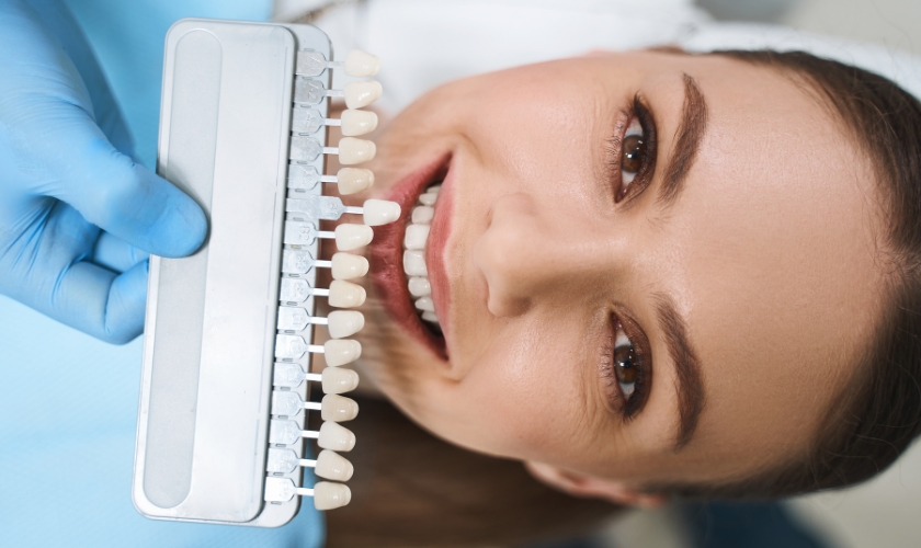 Minimal-Prep Dental Veneers