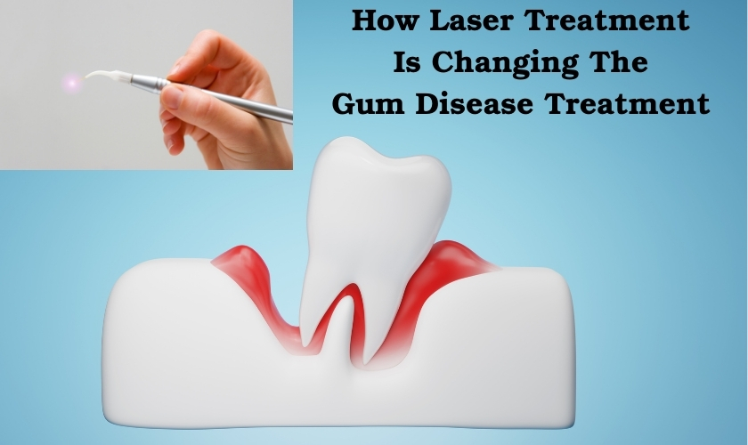 How Laser Treatment Is Changing The Game For Periodontal Disease