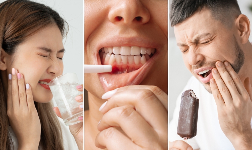 common signs you need a root canal treatment