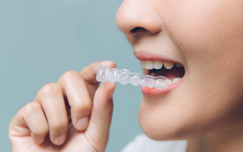 Prevent bad breath while wearing Invisalign